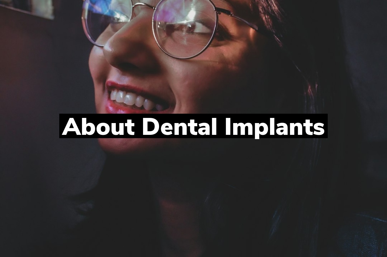 About Dental Implants