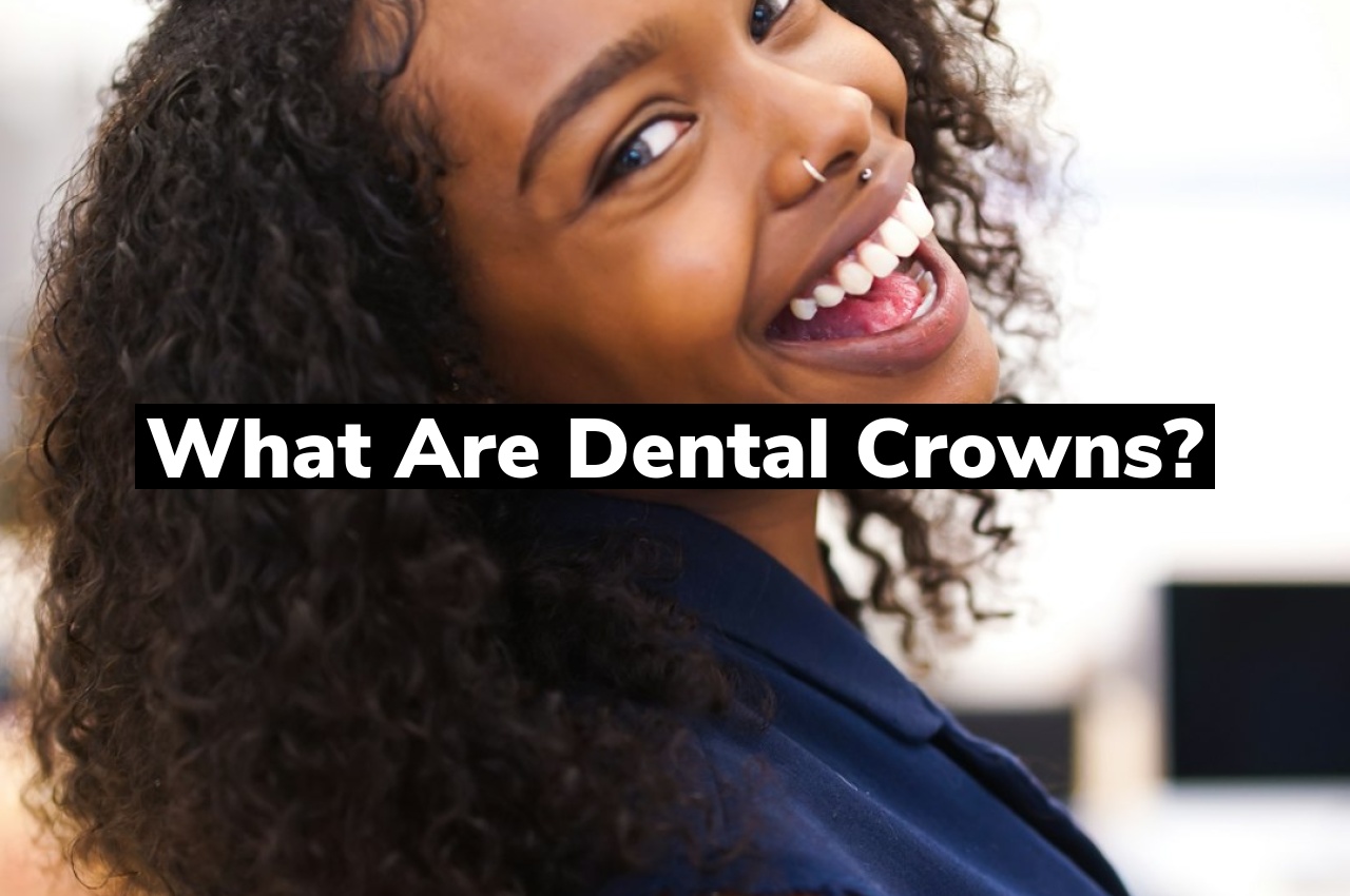 What are Dental Crowns?
